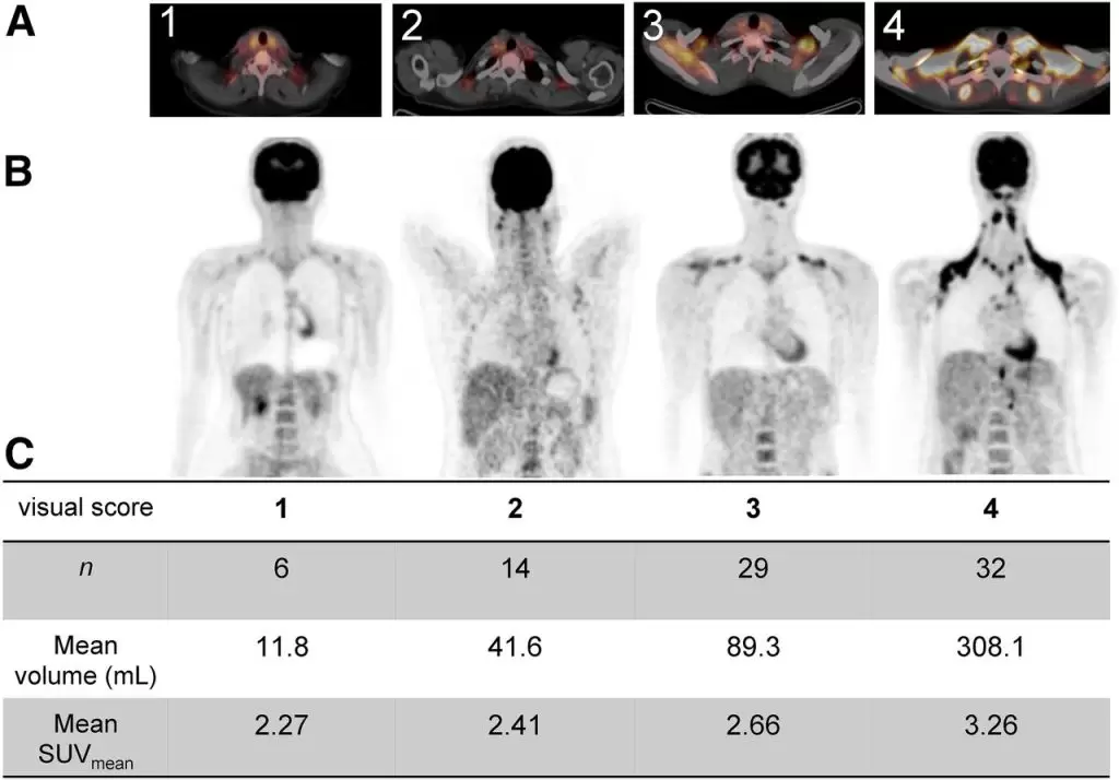 Brown fat activity 18F-FDG PET-CT imaging group