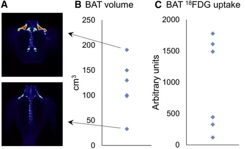 PET/CT identification of supraclavicular BAT and whole-body measurements.