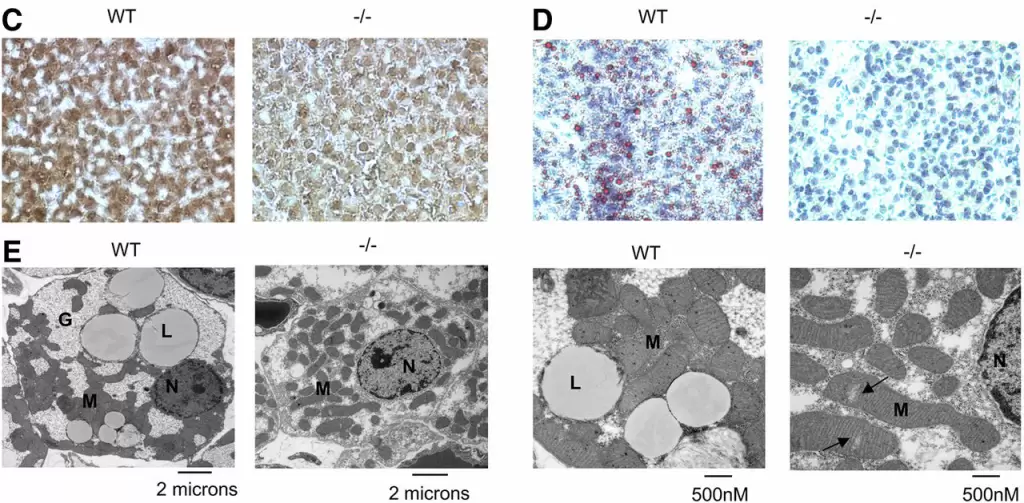 Li, et al. Diabetes 67(3), p400-411, 2018 Mar. UCP1 immunostain and Oil Red O stain in SNRK KO.