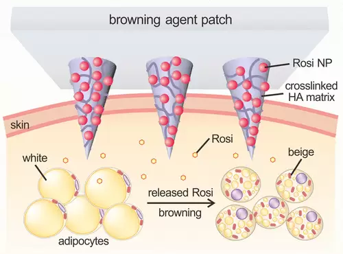 Locally induced adipose tissue browning by microneedle patch for obesity treatment.