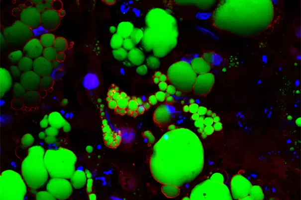 Human pluripotent stem cell-derived fat cells