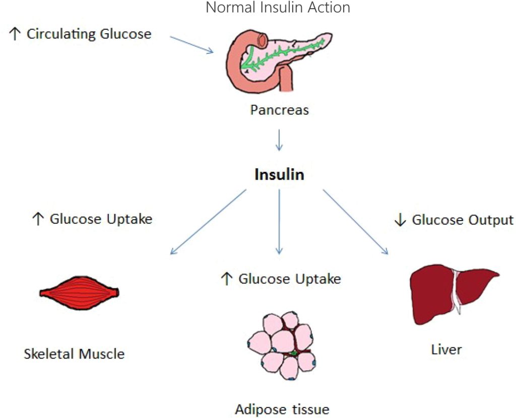 Metabolic Disease – Aracea Therapeutics
